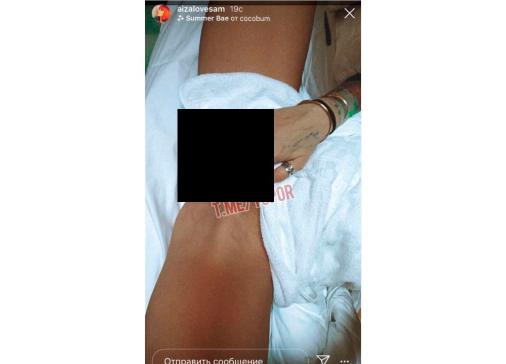 Айза Долматова интимное