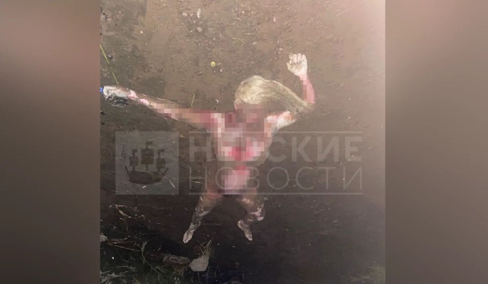 Настя Кочервей дом 2 до пластики