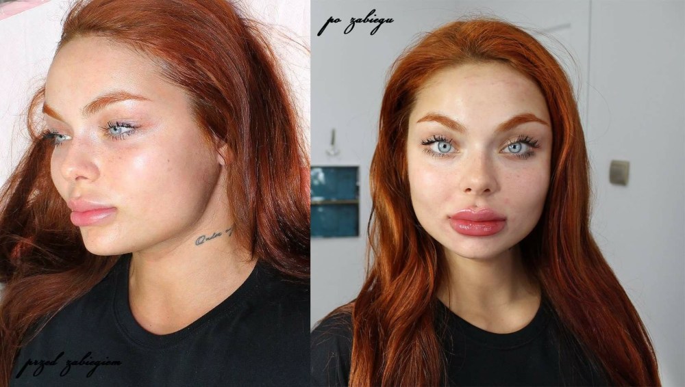 Камила смогулецкая до пластики