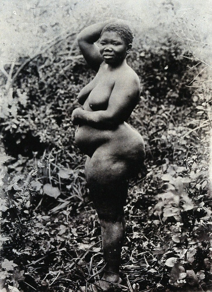 Саарти Бартман половые органы