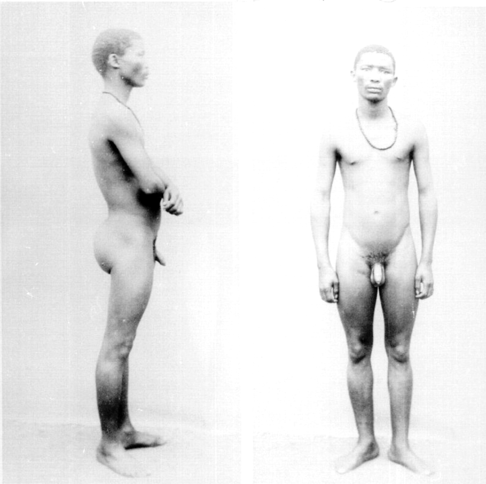 Готтентотские ягодицы