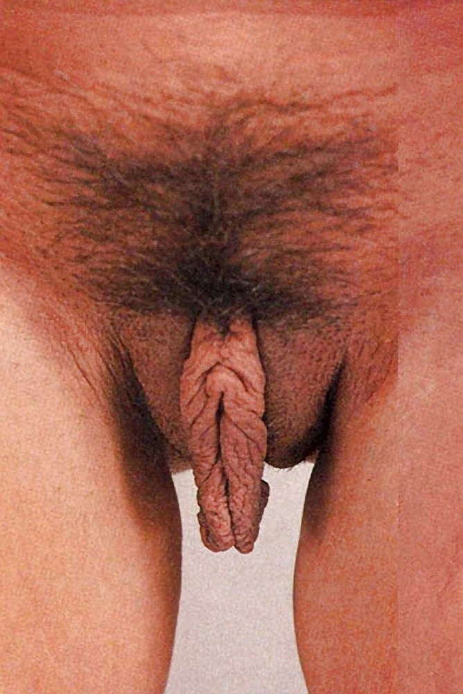 Нестандартные половые органы