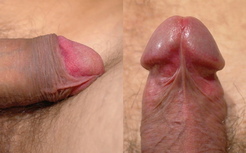 Здоровый половой член головка