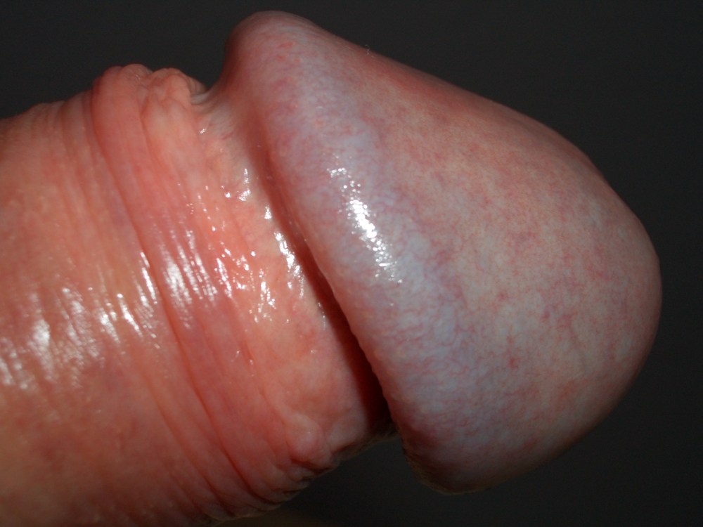 Головка полового члена крупным планом