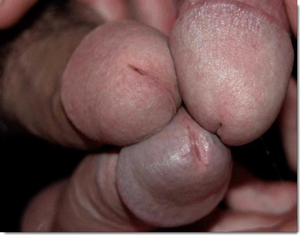 Огромная головка полового члена