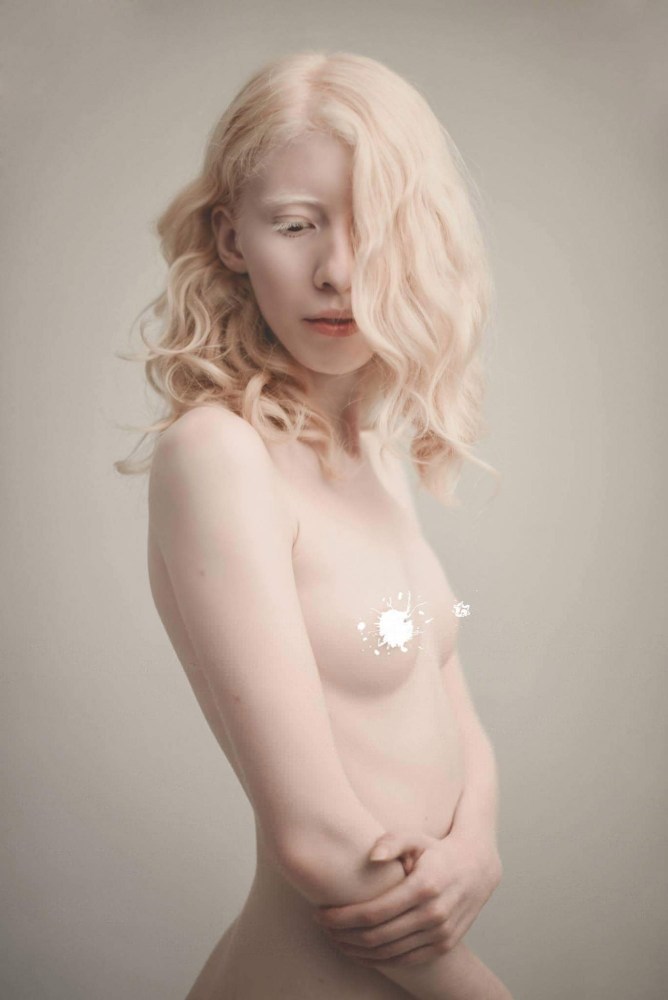Эмма Хикс (Emma Hix)
