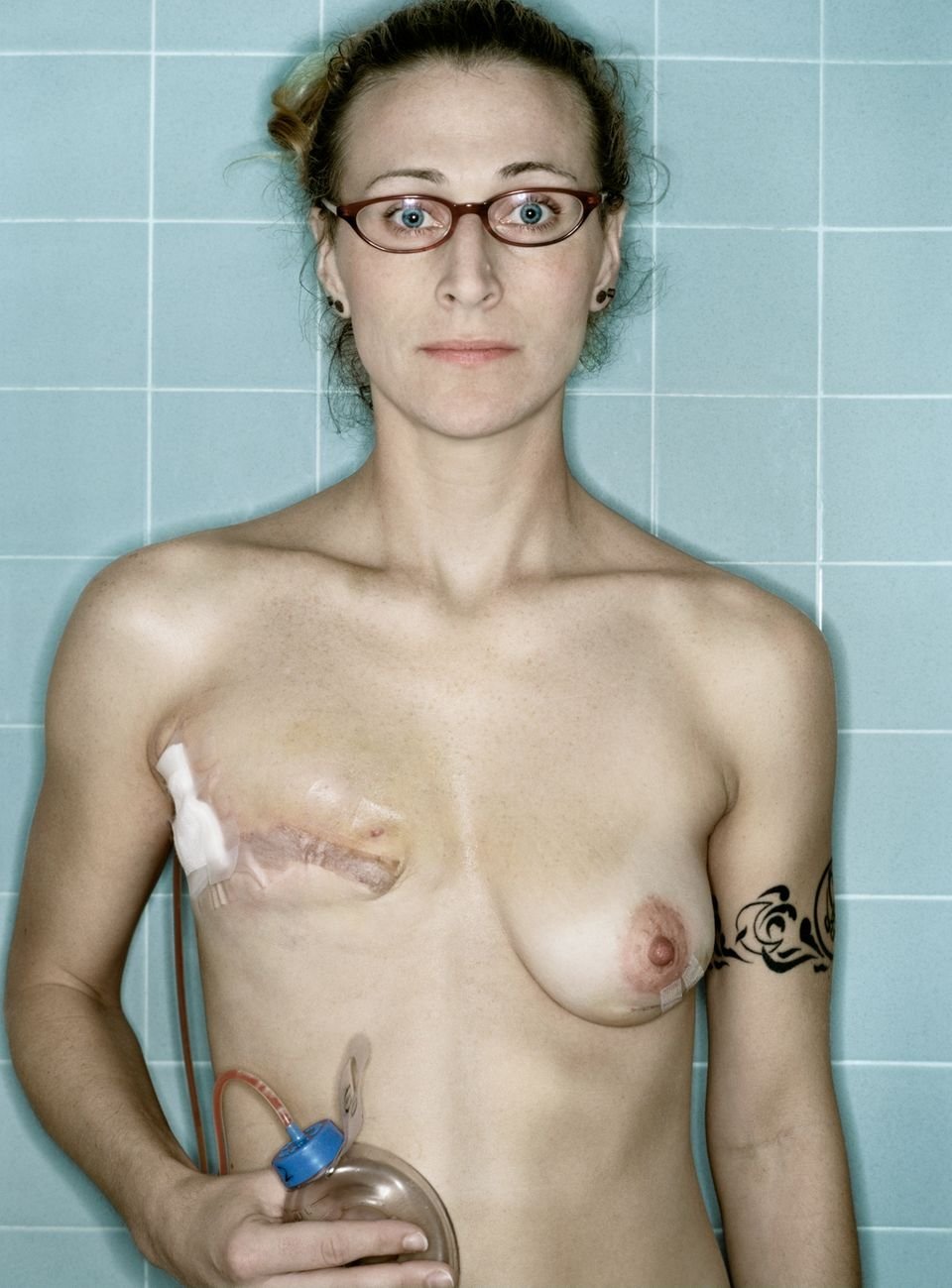 женщины с ампутированными грудями фото фото 3