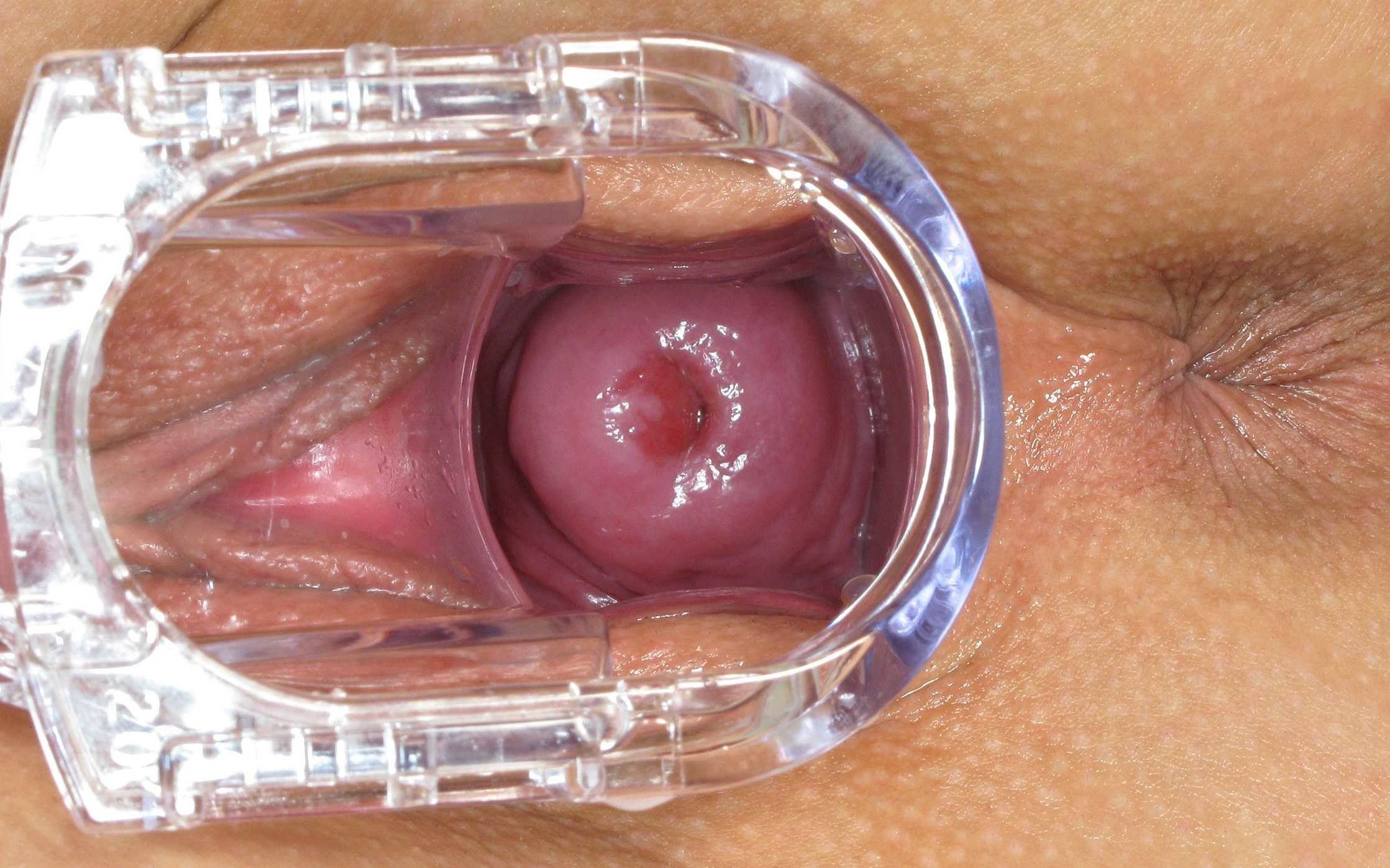 порно изнутри вагины (120) фото