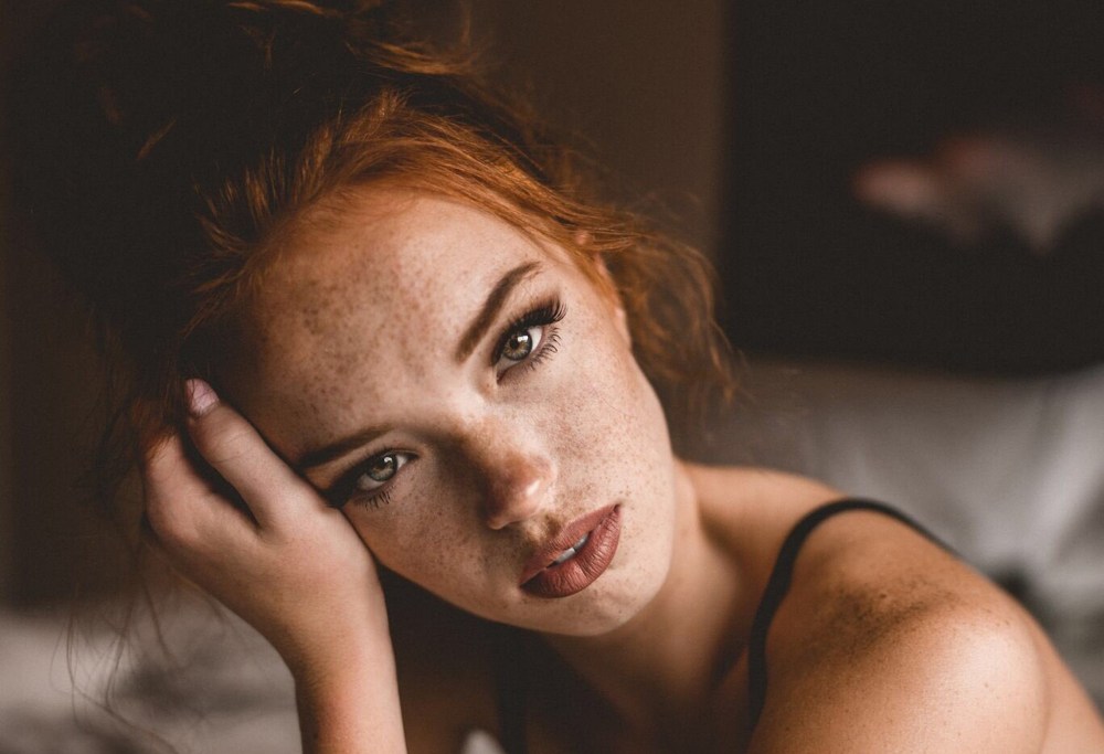 Селина Скиндер веснушки
