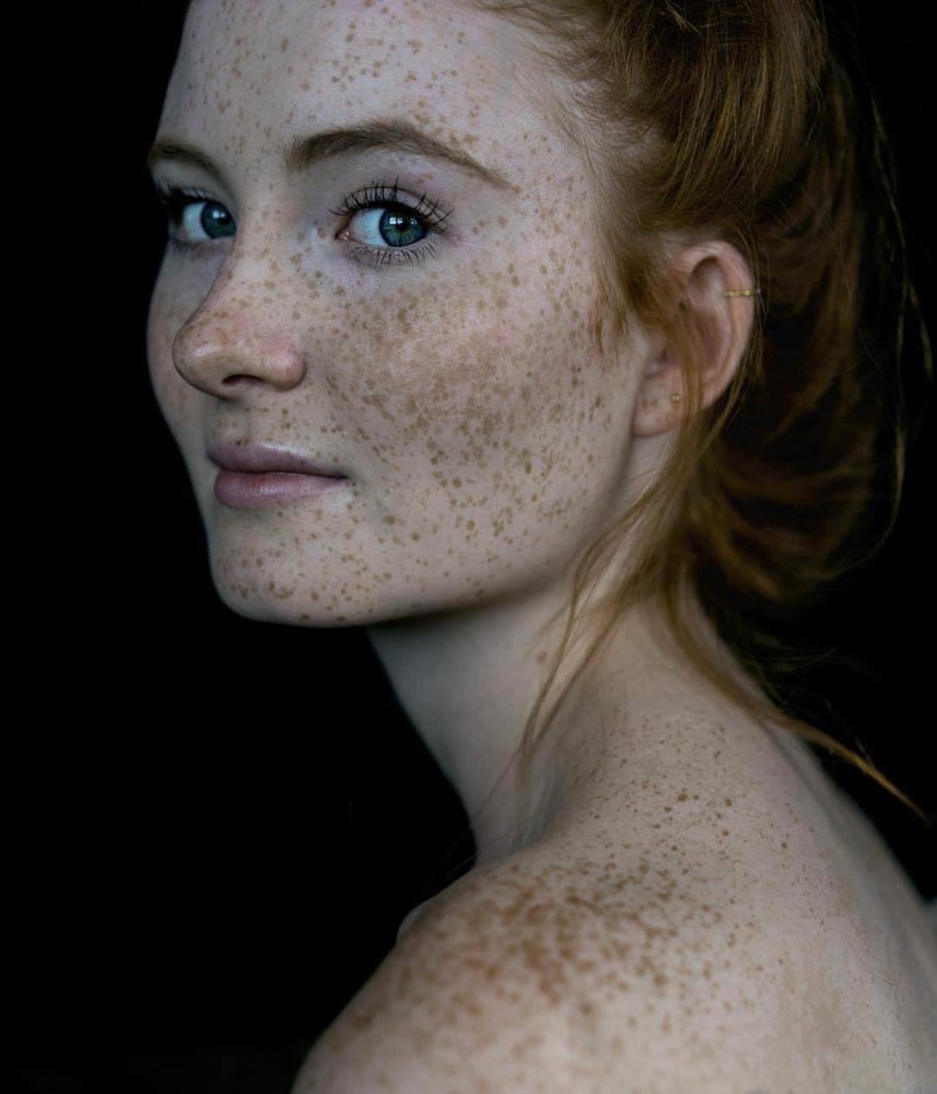 Freckles Эвелина Лашук
