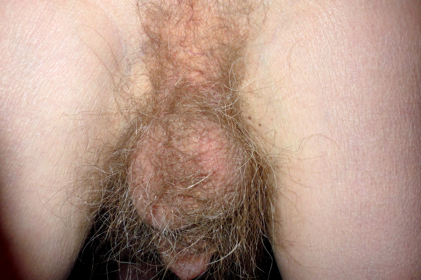 волосы на члене у мужчины фото 6