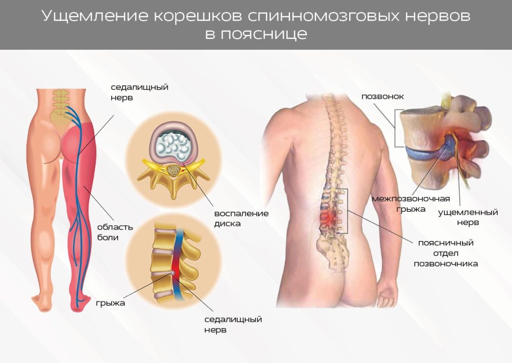 Соединить фразеологизмы